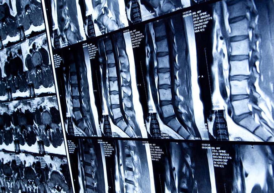 Spine 360° rotation on Behance